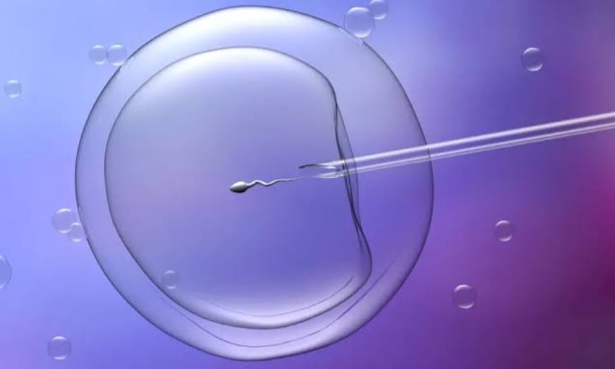 ICSI Treatment